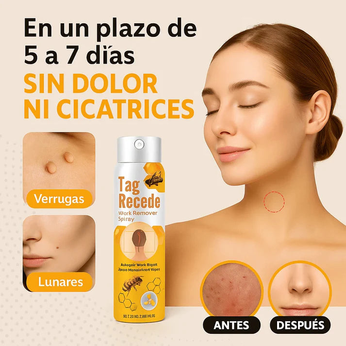 “Olvídate de las verrugas con Tag Recede, el aliado de tu piel”