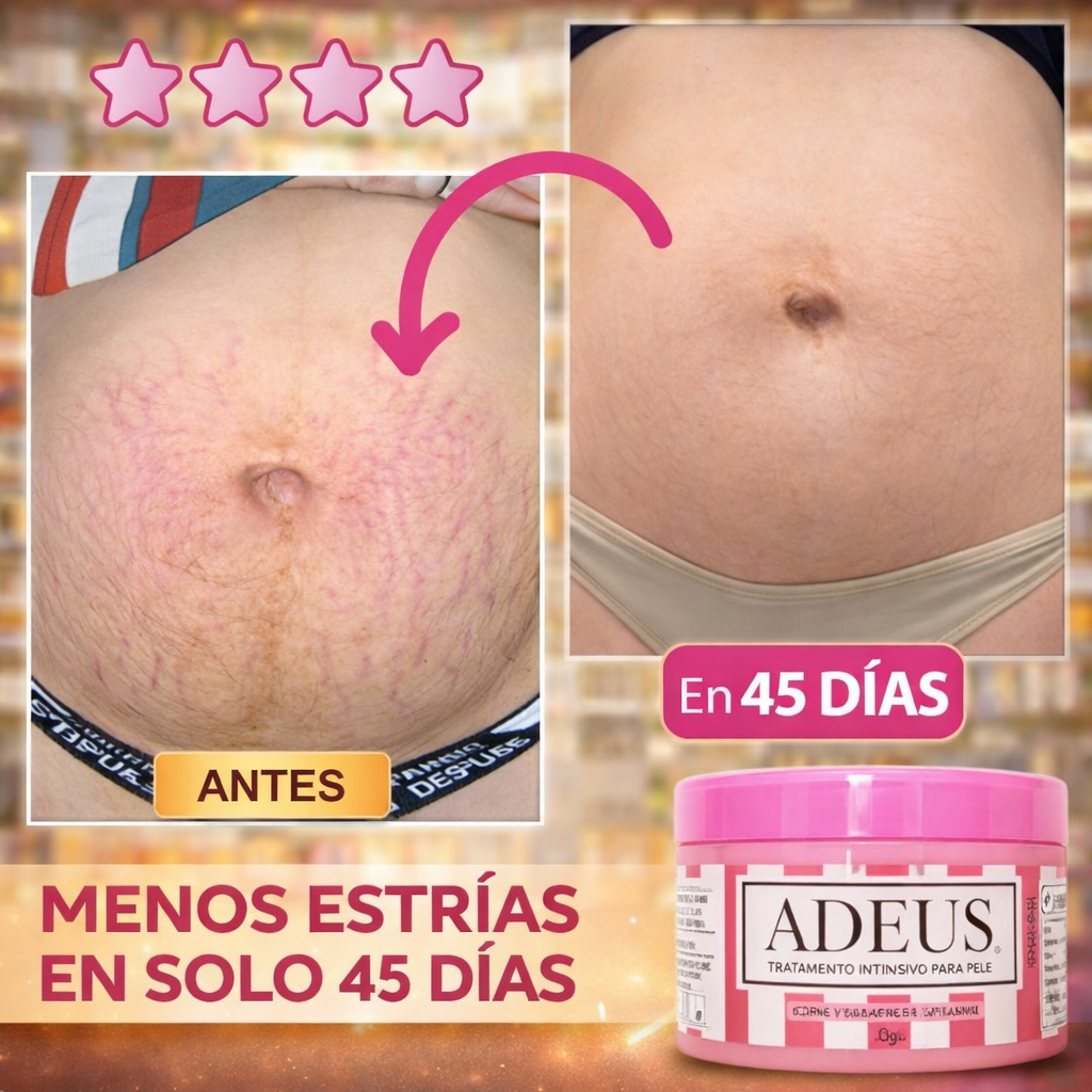 CONTROL TOTAL-CELULITIS Y ESTRÍAS