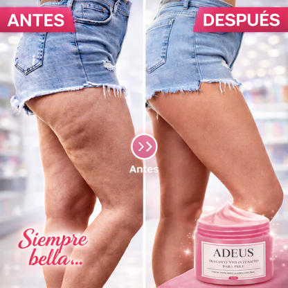 CONTROL TOTAL-CELULITIS Y ESTRÍAS