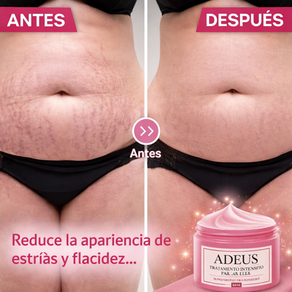 CONTROL TOTAL-CELULITIS Y ESTRÍAS