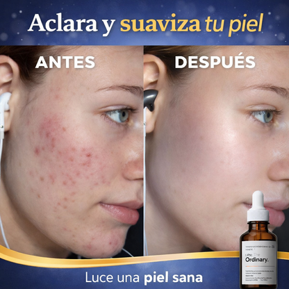 RETINOL-REJUVENECEDOR FACIAL