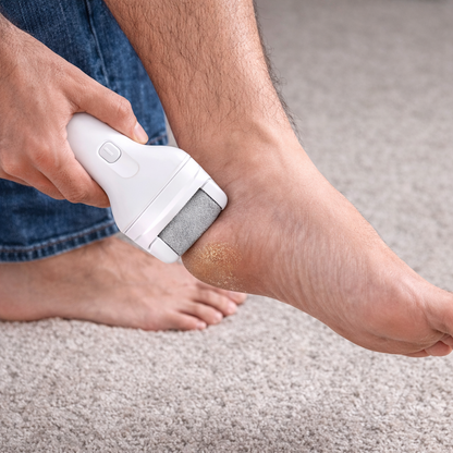 LIMADOR DE CALLOS PREMIUM