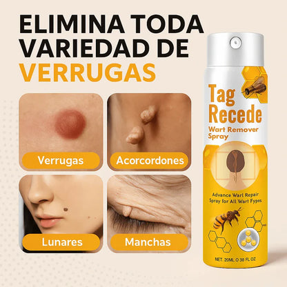 “Olvídate de las verrugas con Tag Recede, el aliado de tu piel”
