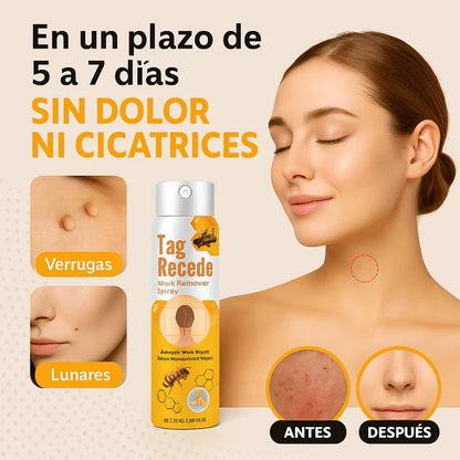 “Olvídate de las verrugas con Tag Recede, el aliado de tu piel”